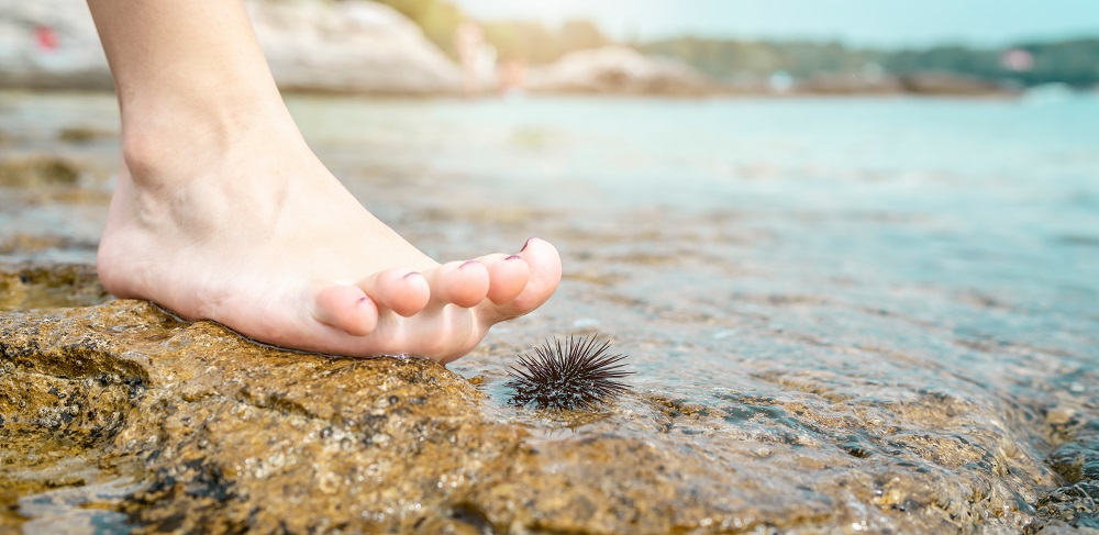 Seeigel Verletzung Strand